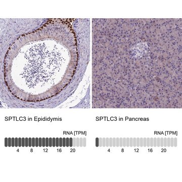 Anti-SPTLC3 antibody produced in rabbit Prestige Antibodies&#174; Powered by Atlas Antibodies, affinity isolated antibody, buffered aqueous glycerol solution