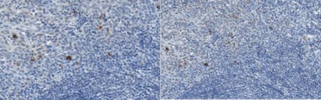 Anti-RANKL Antibody, clone 6A12.1 clone 6A12.1, from mouse