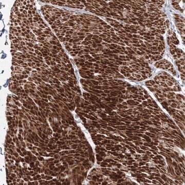 Anti-FAM155B antibody produced in rabbit Prestige Antibodies&#174; Powered by Atlas Antibodies, affinity isolated antibody, buffered aqueous glycerol solution