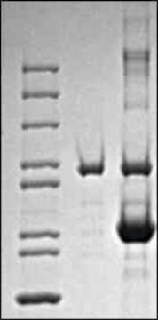 T4 DNA Polymerase Ultra-pure enzyme for nucleic acid modifications