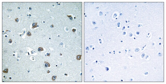 Anti-GNAL antibody produced in rabbit affinity isolated antibody