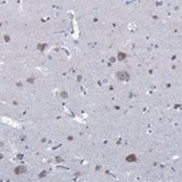 Anti-SLC45A1 antibody produced in rabbit Prestige Antibodies&#174; Powered by Atlas Antibodies, affinity isolated antibody, buffered aqueous glycerol solution