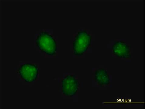 Anti-PARP3 antibody produced in mouse purified immunoglobulin, buffered aqueous solution