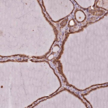 Anti-SLX1A antibody produced in rabbit Prestige Antibodies&#174; Powered by Atlas Antibodies, affinity isolated antibody, buffered aqueous glycerol solution