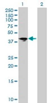 Anti-ART5 antibody produced in mouse purified immunoglobulin, buffered aqueous solution