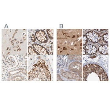 Anti-LRRC47 antibody produced in rabbit Prestige Antibodies&#174; Powered by Atlas Antibodies, affinity isolated antibody, buffered aqueous glycerol solution