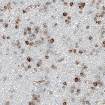 Monoclonal Anti-MTDH antibody produced in mouse Prestige Antibodies&#174; Powered by Atlas Antibodies, clone CL0401, purified immunoglobulin, buffered aqueous glycerol solution