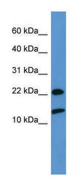 Anti-RPS27A antibody produced in rabbit affinity isolated antibody