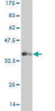 Monoclonal Anti-MUSK antibody produced in mouse clone 1F3, purified immunoglobulin, buffered aqueous solution