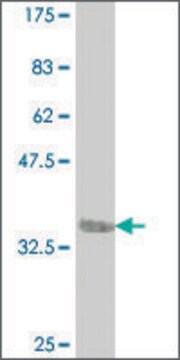 ANTI-FOXC1 antibody produced in mouse clone 1E11, purified immunoglobulin, buffered aqueous solution