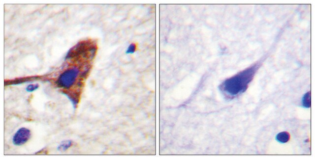 Anti-MTOR antibody produced in rabbit affinity isolated antibody