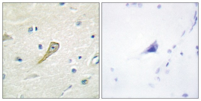 Anti-SEMA4A antibody produced in rabbit affinity isolated antibody