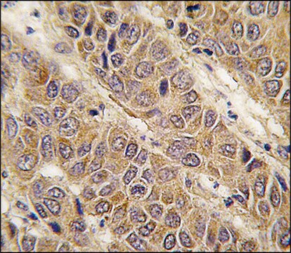 Anti-APOC2 (center) antibody produced in rabbit saturated ammonium sulfate (SAS) precipitated, buffered aqueous solution