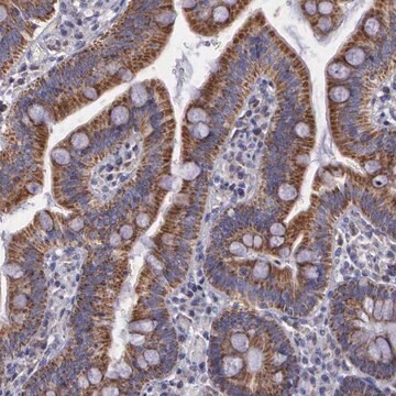 Anti-SYNJ2BP antibody produced in rabbit Prestige Antibodies&#174; Powered by Atlas Antibodies, affinity isolated antibody, buffered aqueous glycerol solution