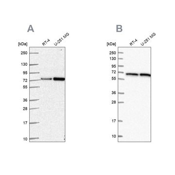 Anti-DLAT antibody produced in rabbit Prestige Antibodies&#174; Powered by Atlas Antibodies, affinity isolated antibody