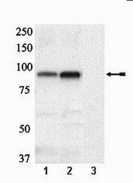 Anticorps anti-phospho-glycogène synthase (Ser641/Ser645) Upstate&#174;, from rabbit