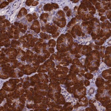 Anti-NOL10 antibody produced in rabbit Prestige Antibodies&#174; Powered by Atlas Antibodies, affinity isolated antibody, buffered aqueous glycerol solution