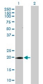 Anti-ANAPC10 antibody produced in rabbit purified immunoglobulin, buffered aqueous solution