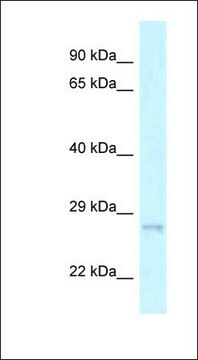 Anti-CHMP2A antibody produced in rabbit affinity isolated antibody