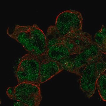 Anti-Stk17B Antibody Produced In Rabbit Prestige Antibodies&#174; Powered by Atlas Antibodies, affinity isolated antibody, buffered aqueous glycerol solution