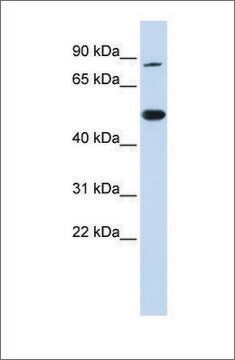 Anti-TRMT1 antibody produced in rabbit affinity isolated antibody