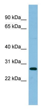 Anti-RPL10A antibody produced in rabbit affinity isolated antibody