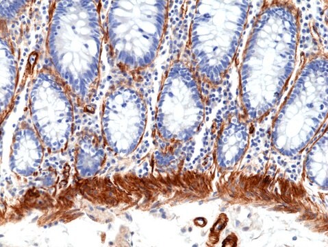 Anti--CALD1 (Caldesmon) Rabbit Monoclonal Antibody clone RM396, affinity purified immunoglobulin