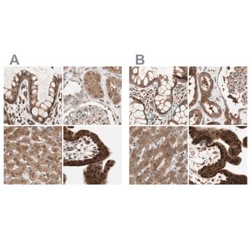 抗IL11RA抗体 ウサギ宿主抗体 Ab1, Prestige Antibodies&#174; Powered by Atlas Antibodies, affinity isolated antibody, buffered aqueous glycerol solution