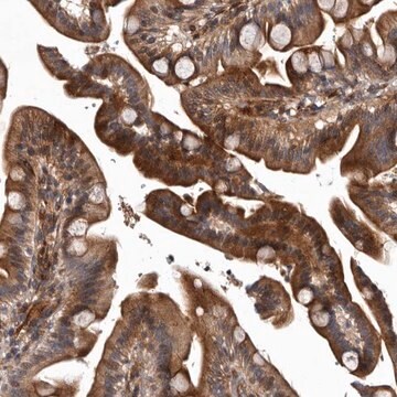 Anti-PRKD3 antibody produced in rabbit Prestige Antibodies&#174; Powered by Atlas Antibodies, affinity isolated antibody, buffered aqueous glycerol solution