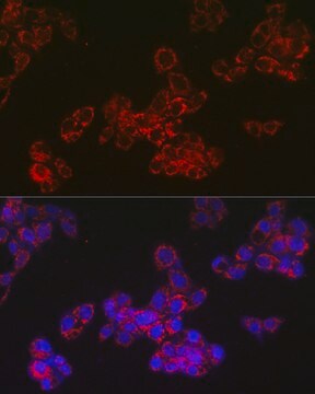 Anti-ACAA2 Antibody, clone 8H6H5, Rabbit Monoclonal