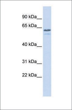 Anti-TRIM6 (ab1) antibody produced in rabbit affinity isolated antibody