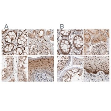 Anti-ZNF521 antibody produced in rabbit Prestige Antibodies&#174; Powered by Atlas Antibodies, affinity isolated antibody, buffered aqueous glycerol solution, Ab2