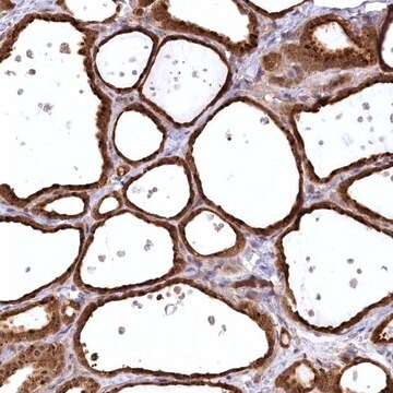 Anti-SERGEF antibody produced in rabbit Prestige Antibodies&#174; Powered by Atlas Antibodies, affinity isolated antibody, buffered aqueous glycerol solution