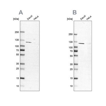 Anti-LEMD3 antibody produced in rabbit Prestige Antibodies&#174; Powered by Atlas Antibodies, affinity isolated antibody, buffered aqueous glycerol solution