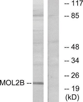 Anti-MOBKL2B antibody produced in rabbit affinity isolated antibody