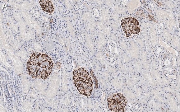 Anti-Nestin Antibody, clone 10C2 ZooMAb&#174; Mouse Monoclonal recombinant, expressed in HEK 293 cells