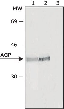 Monoclonal Anti-&#945;1-Acid Glycoprotein antibody produced in mouse clone AGP-47, ascites fluid