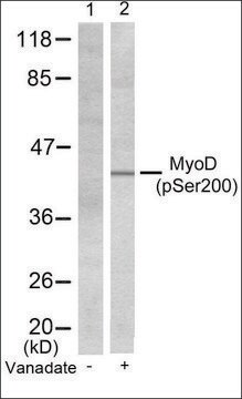 Anti-phospho-MYOD1 (pSer200) antibody produced in rabbit affinity isolated antibody