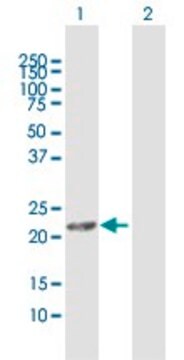 Anti-DHRS11 antibody produced in rabbit purified immunoglobulin, buffered aqueous solution