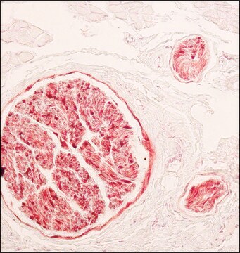 Monoclonal Anti-S-100 (&#946;-Subunit) antibody produced in mouse clone SH-B4, (Solution in 0.01M phosphate buffered saline pH 7.4, containing 15mM sodium azide as a preservative)