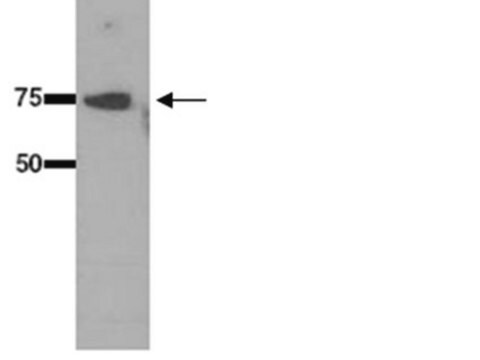 Anti-Heat Shock Protein 70 (HSP 70) Antibody serum, Chemicon&#174;