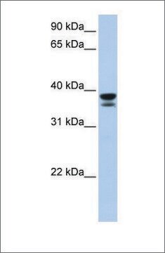 Anti-LGALS9 antibody produced in rabbit affinity isolated antibody