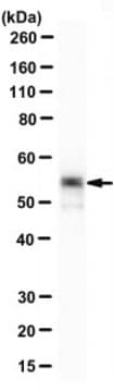 Anti-Cytokeratin-8 Antibody, clone 1E8