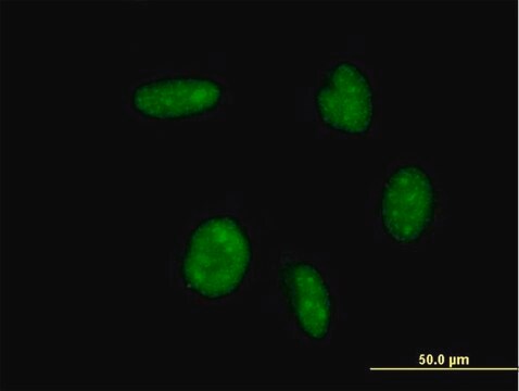 ANTI-ATOH1 antibody produced in mouse clone 4H2, purified immunoglobulin, buffered aqueous solution