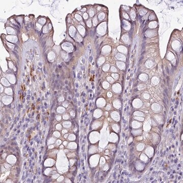 Anti-NAT1 antibody produced in rabbit Prestige Antibodies&#174; Powered by Atlas Antibodies, affinity isolated antibody, buffered aqueous glycerol solution