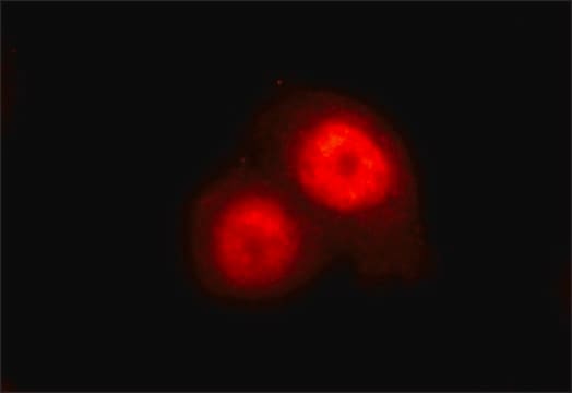 Anti-KLF5 antibody , Mouse monoclonal clone KLF5-55, purified from hybridoma cell culture