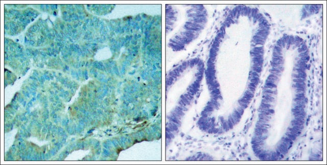 Anti-phospho-EIF2AK2 (pThr446) antibody produced in rabbit affinity isolated antibody