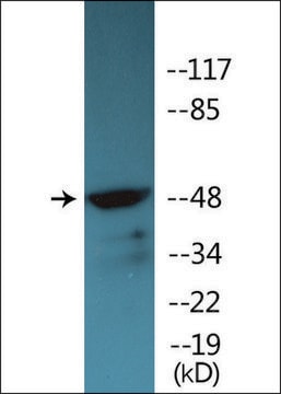 Anti-phospho-Vitamin D Receptor (pSer208) antibody produced in rabbit affinity isolated antibody