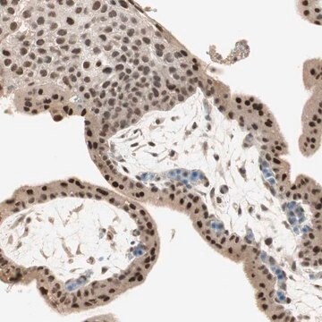 Anti-RNGTT antibody produced in rabbit Prestige Antibodies&#174; Powered by Atlas Antibodies, affinity isolated antibody, buffered aqueous glycerol solution