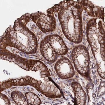 Anti-STAMBPL1 antibody produced in rabbit Prestige Antibodies&#174; Powered by Atlas Antibodies, affinity isolated antibody, buffered aqueous glycerol solution